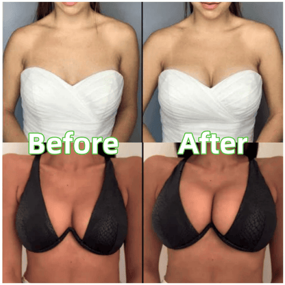 🔥Sonderangebot in limitierter Auflage – 1 kaufen, 1 gratis!🔥 Ultra Boost Pads – Patentierte Klebepads für modische BHs