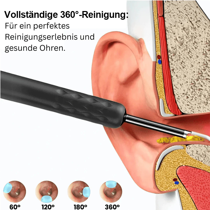 ⏳Begrenzte Zeit 50% Rabatt💥Intelligenter wasserdichter visueller Ohrenschmalzentferner