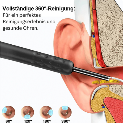 ⏳Begrenzte Zeit 50% Rabatt💥Intelligenter wasserdichter visueller Ohrenschmalzentferner