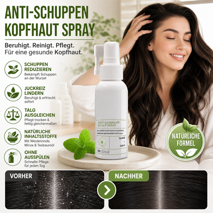 🛡️🌱 Kopfhautspray gegen Schuppen & Juckreiz – beruhigend, feuchtigkeitsspendend – für gesundes Haar! 💪