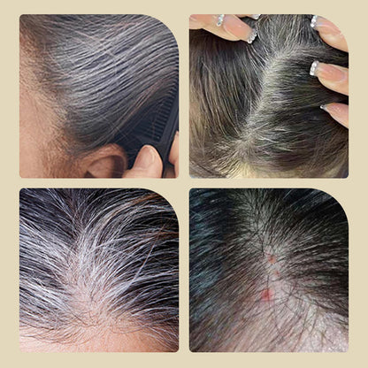 🔥🎁 1+1 GRATIS!! 💞 Haarfärbemittel mit integriertem Kamm | 🌿 Sichere und sanfte Formel ⚡ Schnelle Abdeckung grauer Haare
