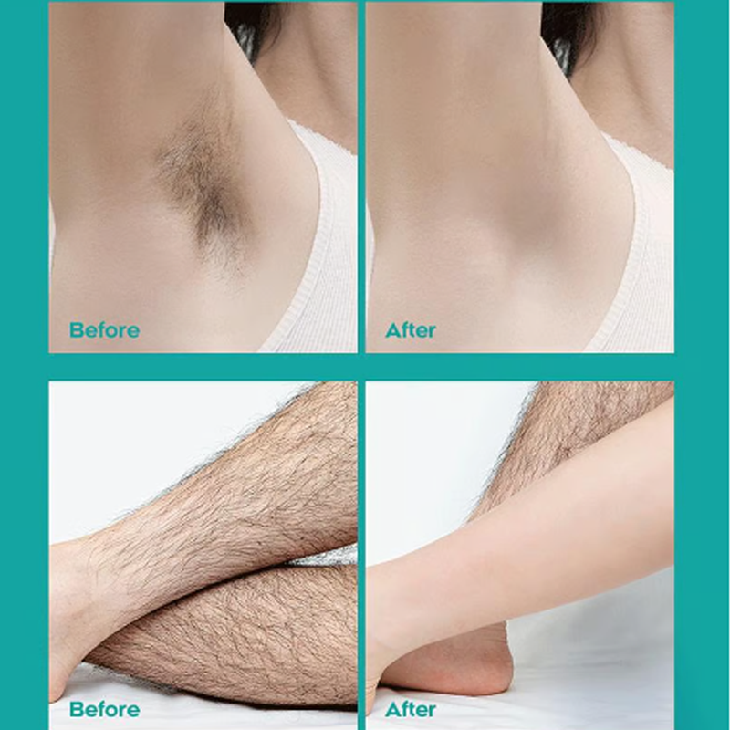 🧴 KAUFE 2, ERHALTE 1 GRATIS! 🌿 Schmerzfreie Haarentfernungscreme mit Aloe Vera – Für Samtweiche Haut in 8 Minuten & Sanft Zur Haut 💖