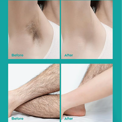 🧴 KAUFE 2, ERHALTE 1 GRATIS! 🌿 Schmerzfreie Haarentfernungscreme mit Aloe Vera – Für Samtweiche Haut in 8 Minuten & Sanft Zur Haut 💖