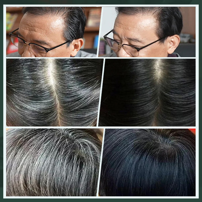 💇‍♀️ KAUFE 2 ERHALTE 1 GRATIS! ✨ Deutsche Pflanzenhaarfarbe für Salon-Perfekte Wurzeln – 100% Pflanzenkraft, Einfache Anwendung & Deckt Graues Haar In 5 Minuten 🌿