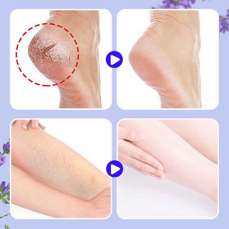 🧴🦶 Anti-Crack Nourishing Foot Repair Balm – Intensive Repair for Dry, Cracked Heels 🧴✨ 24h Feuchtigkeit & Schutz. Ideal für overnächtliche Anwendung. Schnell einziehend. Dermatologisch getestet. Jetzt sparen!