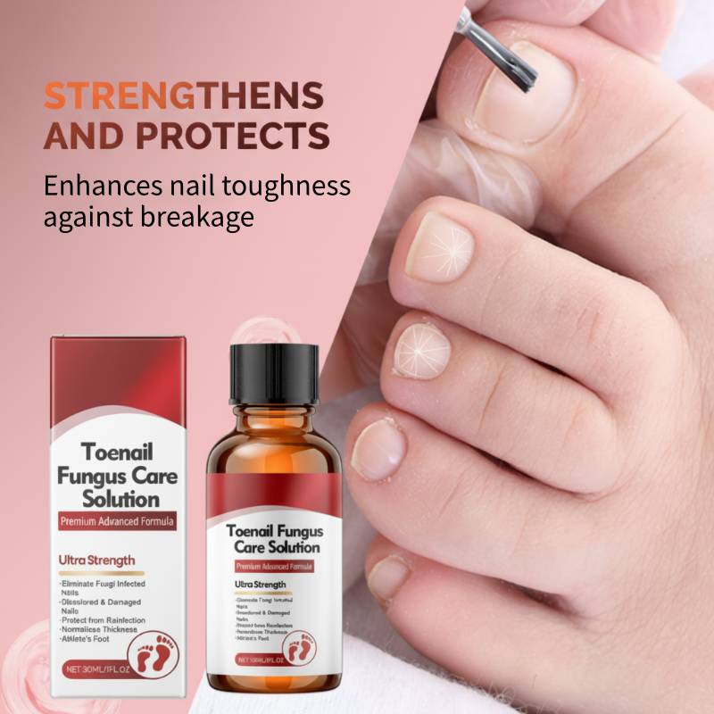 💅🌟 Nägel Reparatur Essenz – Stärkt & regeneriert beschädigte Nägel in 7 Tagen! ✨💪 Sichtbare Ergebnisse, dermatologisch getestet. Deine Lösung für starke, gesunde Nägel.
