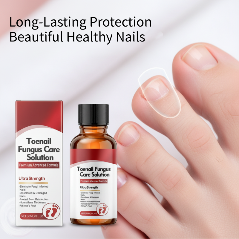 💅🌟 Nägel Reparatur Essenz – Stärkt & regeneriert beschädigte Nägel in 7 Tagen! ✨💪 Sichtbare Ergebnisse, dermatologisch getestet. Deine Lösung für starke, gesunde Nägel.