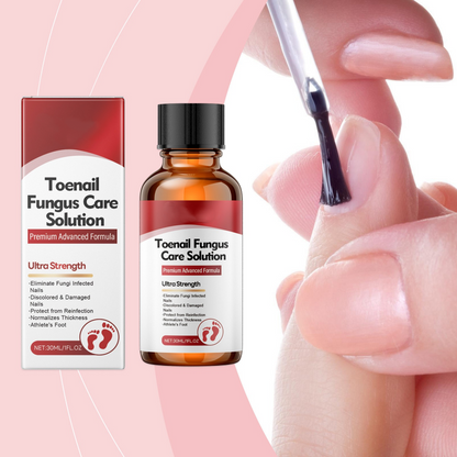 💅🌟 Nägel Reparatur Essenz – Stärkt & regeneriert beschädigte Nägel in 7 Tagen! ✨💪 Sichtbare Ergebnisse, dermatologisch getestet. Deine Lösung für starke, gesunde Nägel.