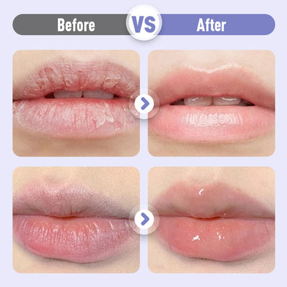 📢📢50 % Rabatt !!Aufpolsterndes und feuchtigkeitsspendendes Lippenserum gegen Falten