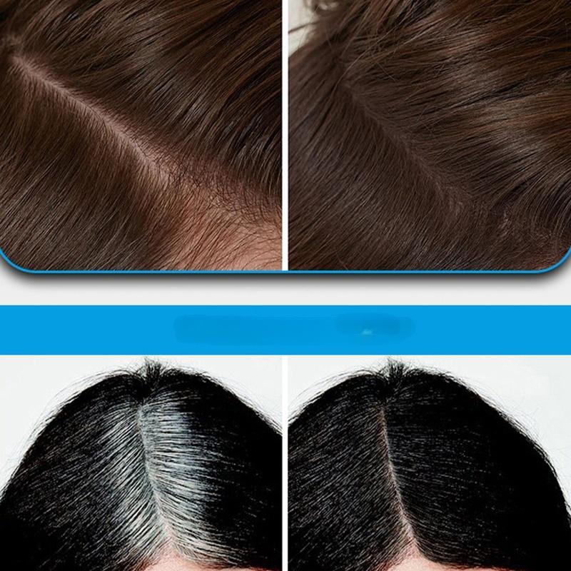 📢📢50 % Rabatt!! ⏰Multifunktionales Instant-Concealer-Haaransatzpuder