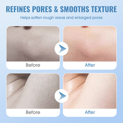 🧴✨ Tiefenreinigendes Peeling-Gel für glattere Haut & verfeinerte Poren 🌿💧 mit hautschonendem pH 5.5