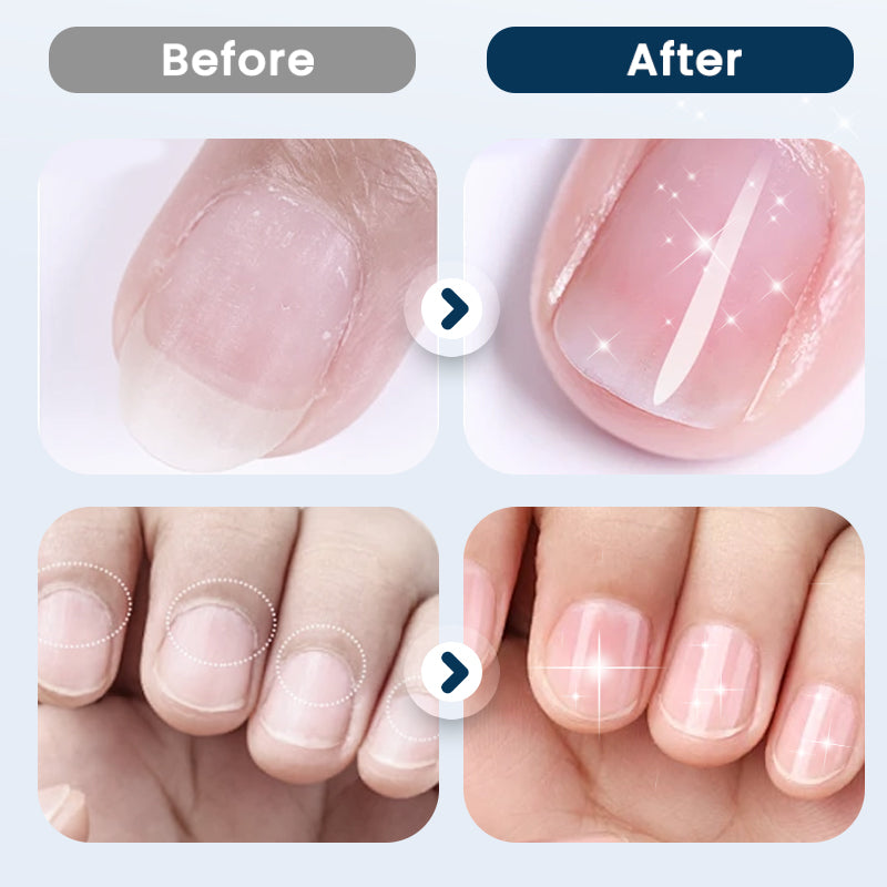 Nährendes Nagelreparaturspray