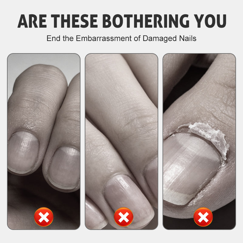 Nährendes Nagelreparaturspray