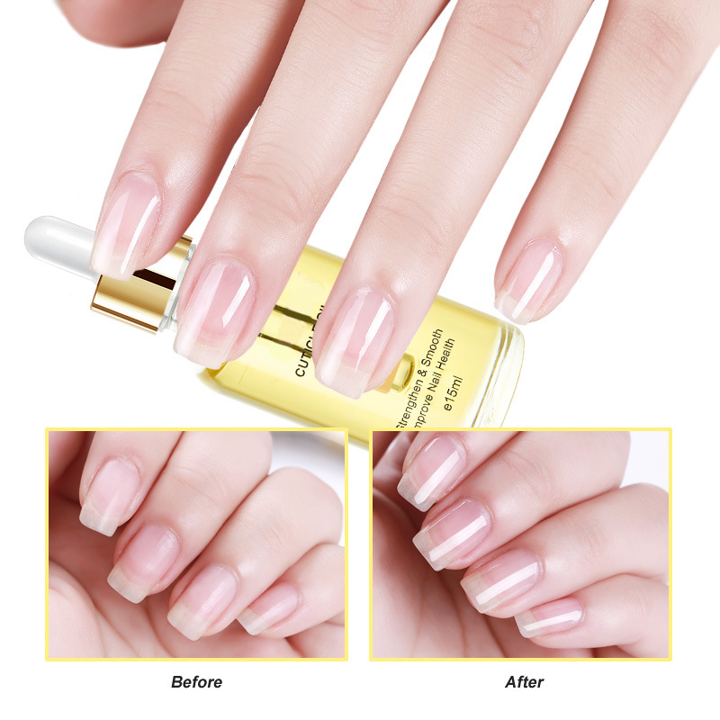 Ätherisches Nagelhautöl mit Pipette