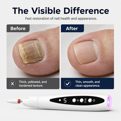 💅✨ 2-in-1 Nagelfräser & UV-Lampe – fräsen, polieren, aushärten – professionelle Maniküre & Pediküre zu Hause! 💖