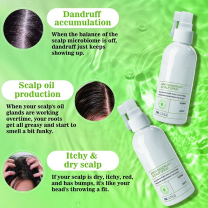 🛡️🌱 Kopfhautspray gegen Schuppen & Juckreiz – beruhigend, feuchtigkeitsspendend – für gesundes Haar! 💪