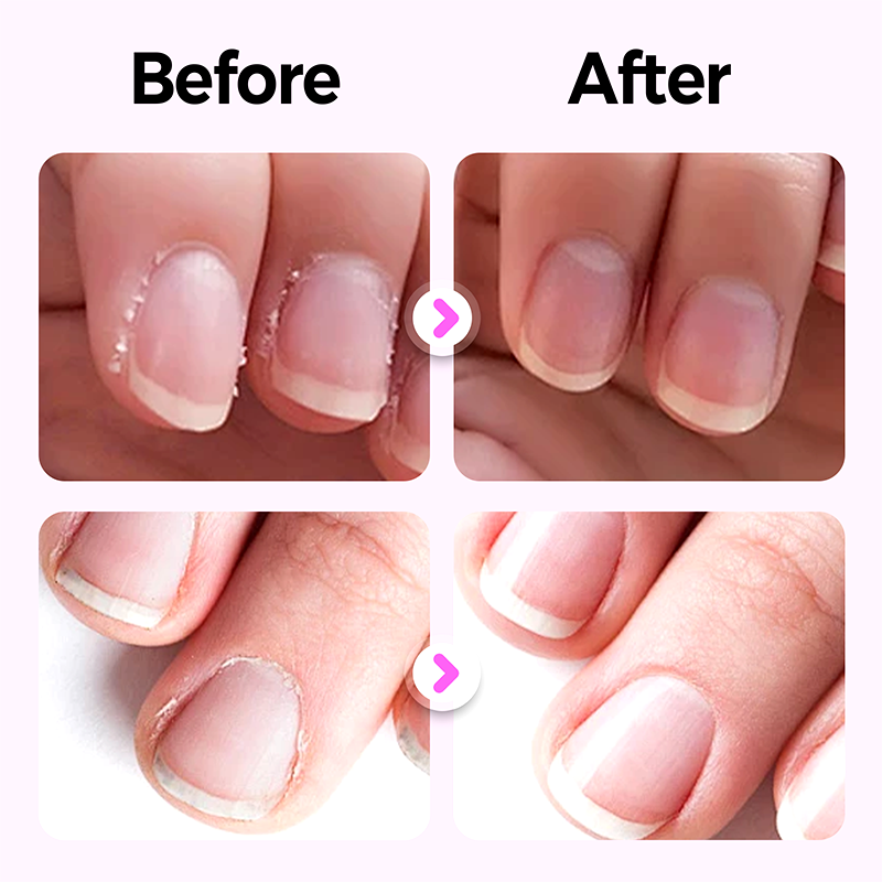 3-in-1 Nagelpflegestift