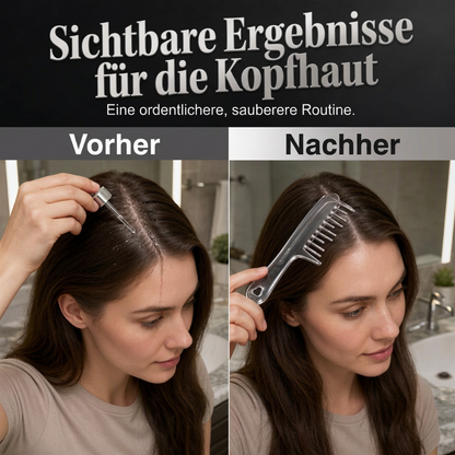 Sofortige Kopfhautpflege! Präzisions-Flüssigapplikator-Kamm